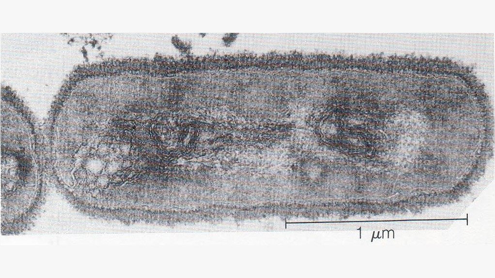 BACTERIUM A photo of a bacterium shows its minuscule size and internal organelles