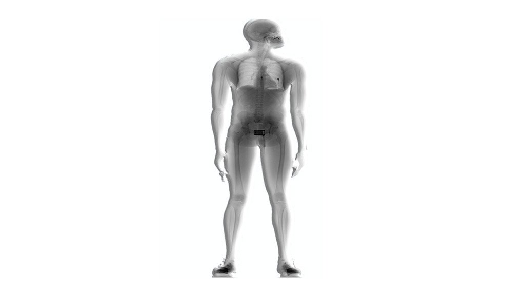 DIAMOND DIGESTION 
Scannex is a full-body scanner with a low X-ray radiation dose that allows for quick scan time
