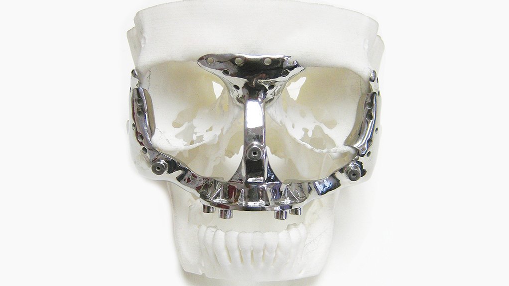 HIGHEST STANDARD A medical implant fitted to a preoperation model printed in plastic from scans of the patient