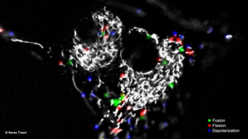 Stellenbosch researchers make major advance in imaging biochemical processes in cells
